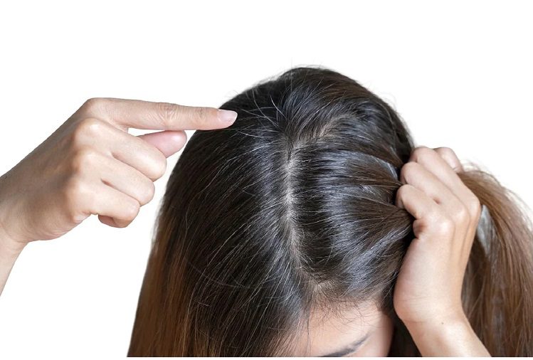 Beauty Tips: If you are also troubled by gray hair, you can do this remedy, you will get benefit