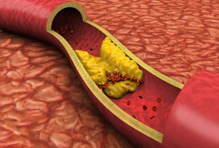 Health Tips: These things reduce bad cholesterol, use this way
