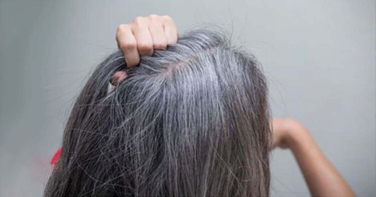 इन 3 गलतियों के कारण बाल होने लगते हैं सफेद
