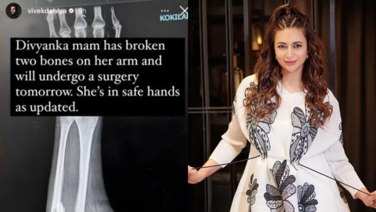 Divyanka Tripathi का हुआ एक्सीडेंट, टूटी हाथ की दो हड्डियां, 1 Divyanka Tripathi का हुआ एक्सीडेंट, टूटी हाथ की दो हड्डियां,