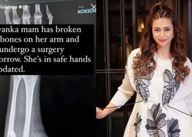 Divyanka Tripathi का हुआ एक्सीडेंट, टूटी हाथ की दो हड्डियां,