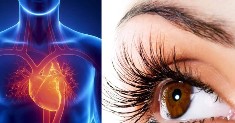 हार्ट अटैक के संकेतः आंखों में दिखें इस तरह के लक्षण तो हो जाएं सावधान