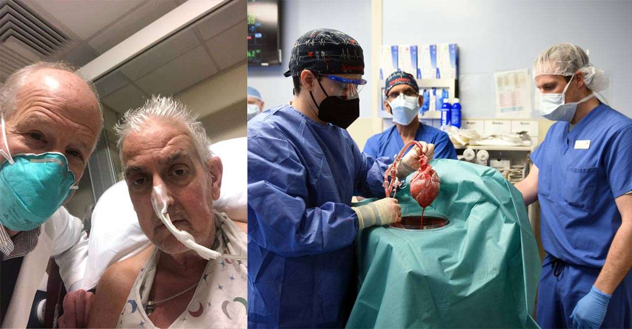 In a medical first, US surgeons transplant pig heart into human