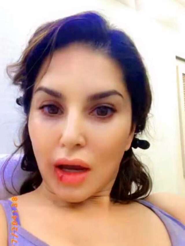 cropped-Sunny-leone-assaulted-know-the-whole-matter.jpg