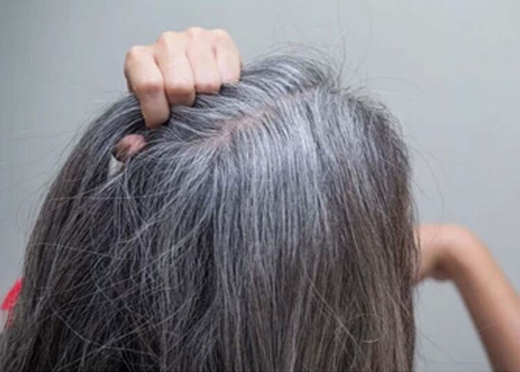 इन 3 गलतियों के कारण बाल होने लगते हैं सफेद