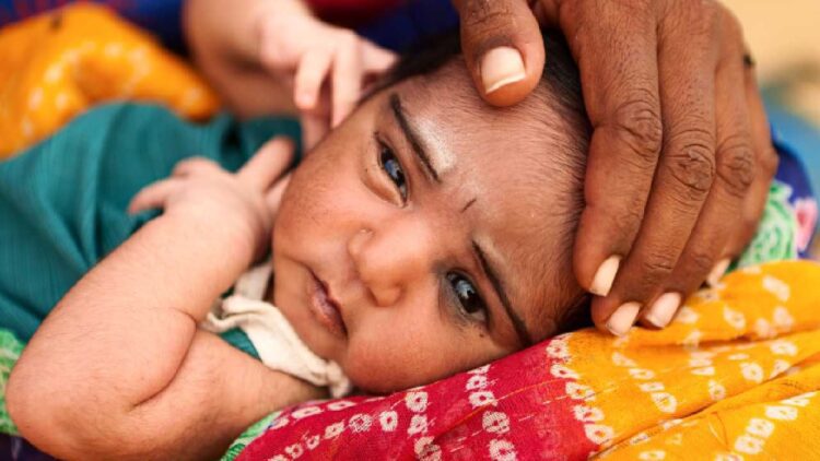 केरल में फिर से बढ़ रहे हैं मम्प्स के मामले, इस राज्य में बार बार क्यों फैल रही है ये बीमारी? 1 केरल में फिर से बढ़ रहे हैं मम्प्स बीमारी के मामले, क्या है कारण?