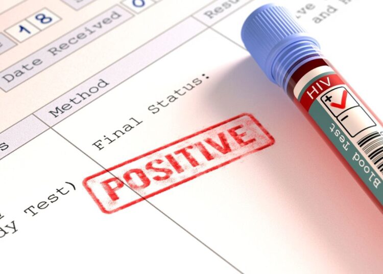 क्या एचआईवी के मरीज को कैंसर भी हो सकता है? एक्सपर्ट्स से जानें