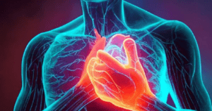 Heart Attack