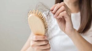 Hair Problems