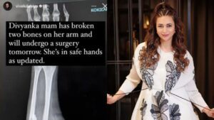 Divyanka Tripathi का हुआ एक्सीडेंट, टूटी हाथ की दो हड्डियां,