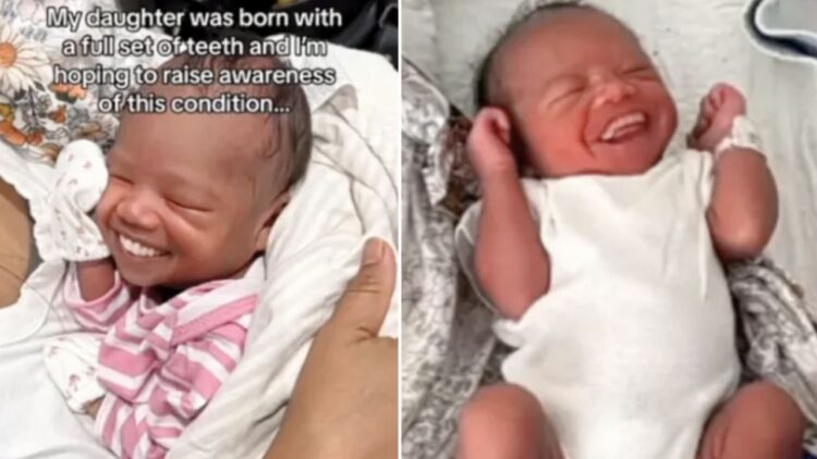32 दांतों के साथ पैदा हुई बच्ची, VIDEO देख हैरान रह गए लोग