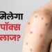 दिल्ली के 6 अस्पतालों में मिलेगा मंकीपॉक्स का इलाज!