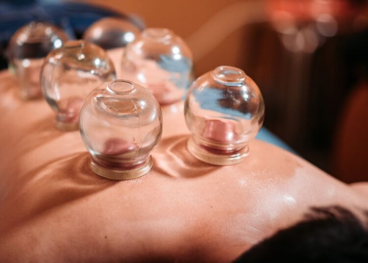 क्या होती है कपिंग थेरेपी? स्किन और सेहत दोनों के लिए है फायदेमंद