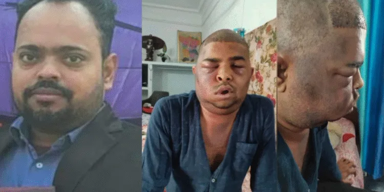 Hair Transplant two died