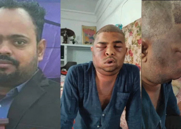 Hair Transplant two died