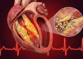 Dyslipidemia