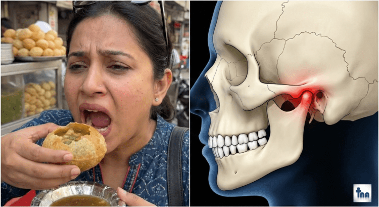 Jaw Dislocation Golgappa