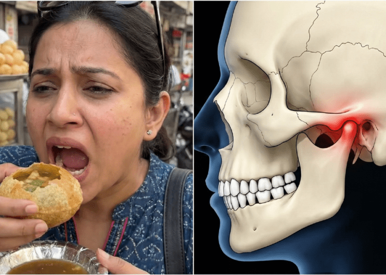 Jaw Dislocation Golgappa