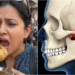 Jaw Dislocation Golgappa