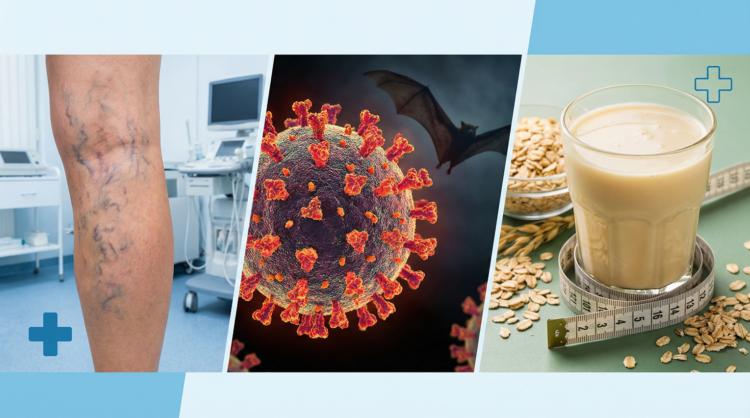 Varicose Veins Treatment