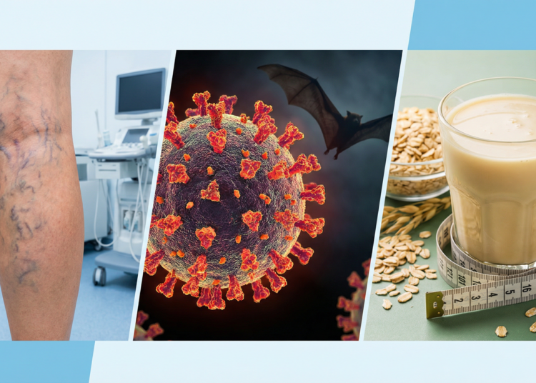 Varicose Veins Treatment