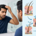 25 की उम्र में Balding: Indian Men को क्या हो रहा है? 13 Early Balding Indian Men Age 25